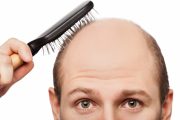 5 Factors that can Influence Hair Loss