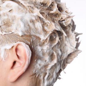 How to treat scaly and itchy lesions found on the scalp
