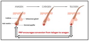 PRP Encourages Hair Conversion from telogen to anagen