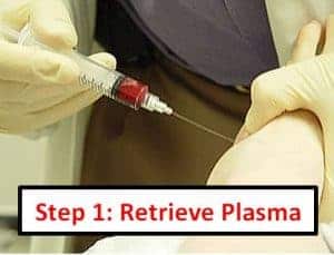 Obtain Blood Plasma Illustration