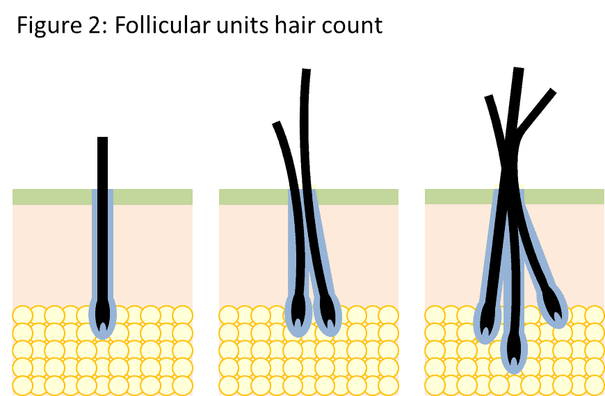 Hair follicles grow in groups of 1-4