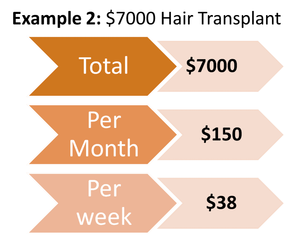 Hair Transplant Archives - Trusmiles Advance Hair And Dental Center