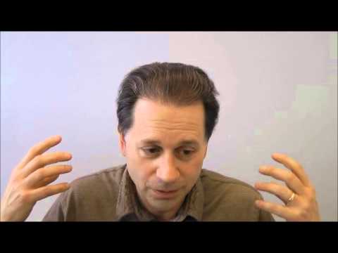 Hair Transplant Review Video Norwood 7 patient