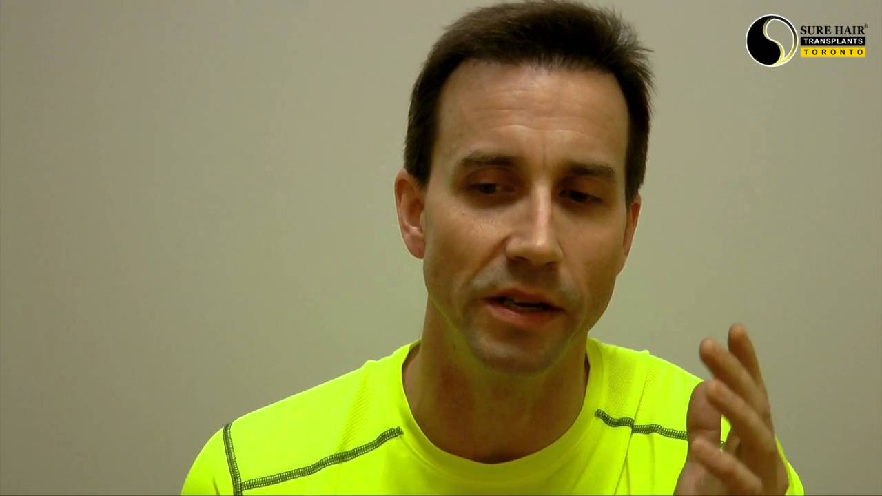 Amazing! 3500 grafts FUT only 6 months/50% growth !! Patient Testimonial